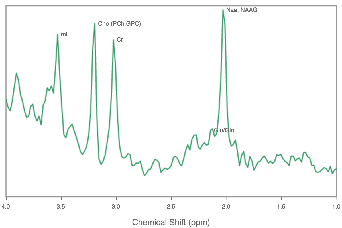 Chemical shift graph