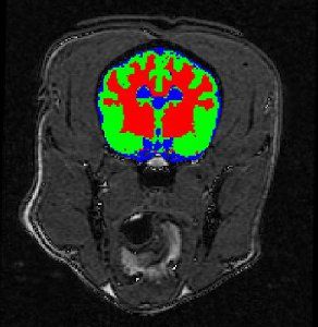 Segmented Brain